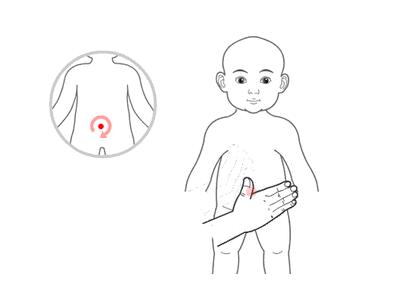 小兒推拿治療感冒嗎？